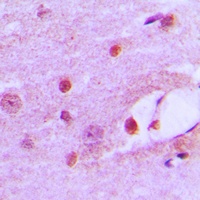 MSH6 Rabbit Polyclonal Antibody