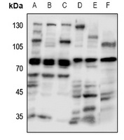 GUCY1A3 Rabbit Polyclonal Antibody