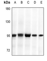 GYS1 Rabbit Polyclonal Antibody