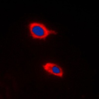 HCCS Antibody