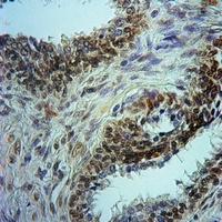 Histone Deacetylase 1 (Phospho-S421) Antibody