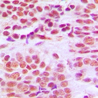 Histone Deacetylase 1 Rabbit Polyclonal Antibody