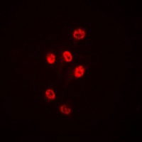 Histone Deacetylase 1 Rabbit Polyclonal Antibody