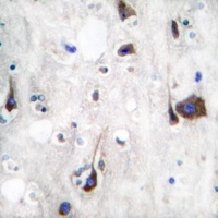 Neuregulin SMDF Rabbit Polyclonal Antibody