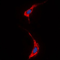 Neuregulin SMDF Rabbit Polyclonal Antibody