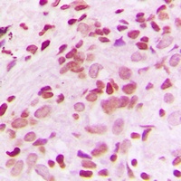 NUR77 Rabbit Polyclonal Antibody