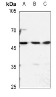 hnRNP H Rabbit Polyclonal Antibody