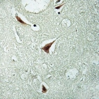 hnRNP K (Phospho-S284) Antibody