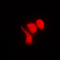 hnRNP K (Phospho-S284) Antibody