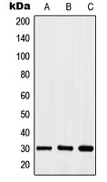 HOXA11/D11 Antibody