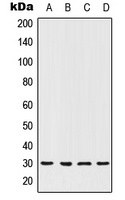 HOXC12 Rabbit Polyclonal Antibody