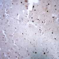 HOXC12 Rabbit Polyclonal Antibody