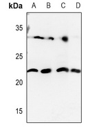 HOXD12 Rabbit Polyclonal Antibody