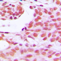 HOXD12 Rabbit Polyclonal Antibody