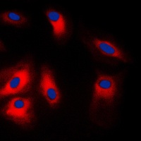 GRP78 Rabbit Polyclonal Antibody