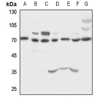 HSC70 Rabbit Polyclonal Antibody