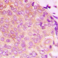 HSP60 Antibody [KO/KD Validated]