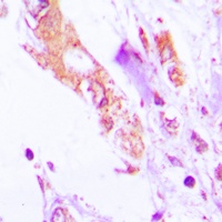 IL-1 beta Rabbit Polyclonal Antibody