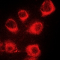 MYL9 (Phospho-S20) Antibody
