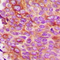 IL-5 Antibody