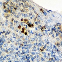 IL-17 Antibody