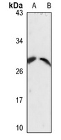 CD49f LC Rabbit Polyclonal Antibody