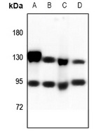 CD51 HC Rabbit Polyclonal Antibody