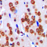 CD51 HC Rabbit Polyclonal Antibody