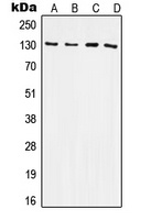 CD61 Rabbit Polyclonal Antibody