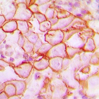 CD61 Rabbit Polyclonal Antibody