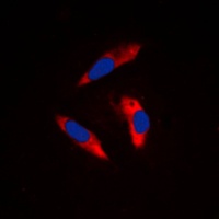 CD61 Rabbit Polyclonal Antibody