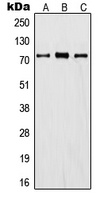 ITIH1 Rabbit Polyclonal Antibody