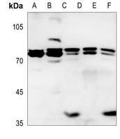 ITPKB Rabbit Polyclonal Antibody