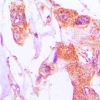 Involucrin Rabbit Polyclonal Antibody