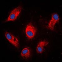 Involucrin Rabbit Polyclonal Antibody