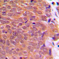 Cofilin (Phospho-S3) Antibody