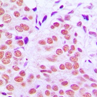 c-Jun (Phospho-T91) Rabbit Polyclonal Antibody