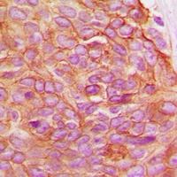 Gamma-catenin Rabbit Polyclonal Antibody
