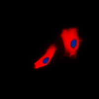 Gamma-catenin Rabbit Polyclonal Antibody