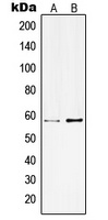 Kv3.1 Rabbit Polyclonal Antibody