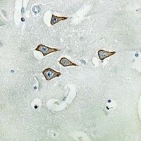 Kv3.1 Rabbit Polyclonal Antibody