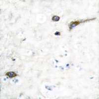 Kv3.2 Rabbit Polyclonal Antibody