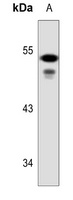 Cytokeratin 7 Rabbit Polyclonal Antibody