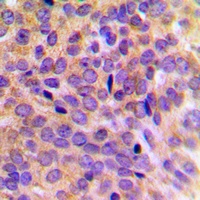 Cytokeratin 7 Rabbit Polyclonal Antibody