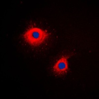 Cytokeratin 7 Rabbit Polyclonal Antibody