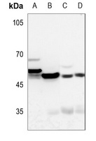 Cytokeratin 17 Rabbit Polyclonal Antibody