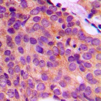 Cytokeratin 17 Rabbit Polyclonal Antibody