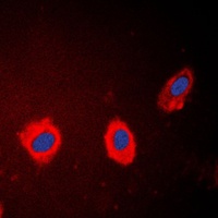 Cytokeratin 17 Rabbit Polyclonal Antibody