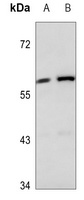 Cytokeratin 84 Rabbit Polyclonal Antibody