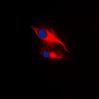LCK (Phospho-Y393) Antibody